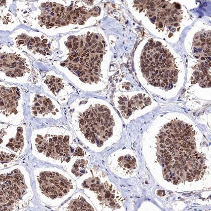 Stat3 Recombinant Rabbit mAb (S-1393-64)