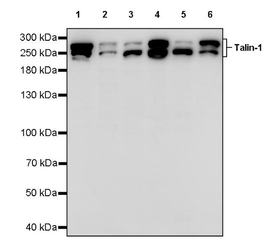 Talin-1 Recombinant Rabbit mAb (S-1483-25)
