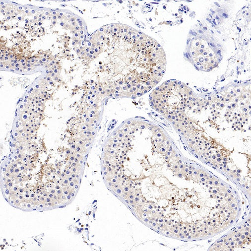 Rab11 Recombinant Rabbit mAb (S-1601-68)