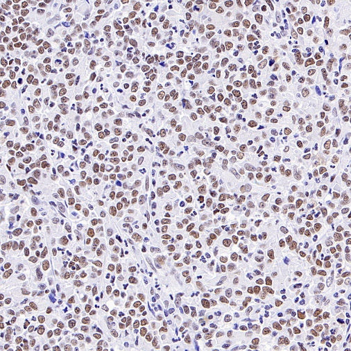 Caspase-8 Recombinant Rabbit mAb (S-2676-74)