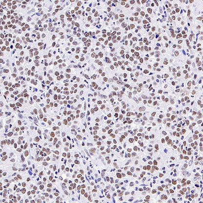 Caspase-8 Recombinant Rabbit mAb (S-2676-74)