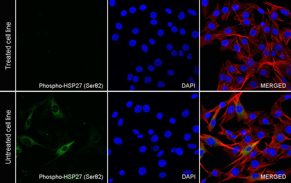 Phospho-HSP27 (Ser82) Recombinant Rabbit mAb (S-4792)