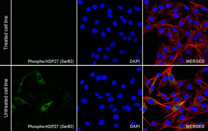 Phospho-HSP27 (Ser82) Recombinant Rabbit mAb (S-4792)