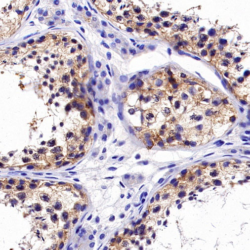 CD112/Nectin-2 Recombinant Rabbit mAb (S-2404-66)