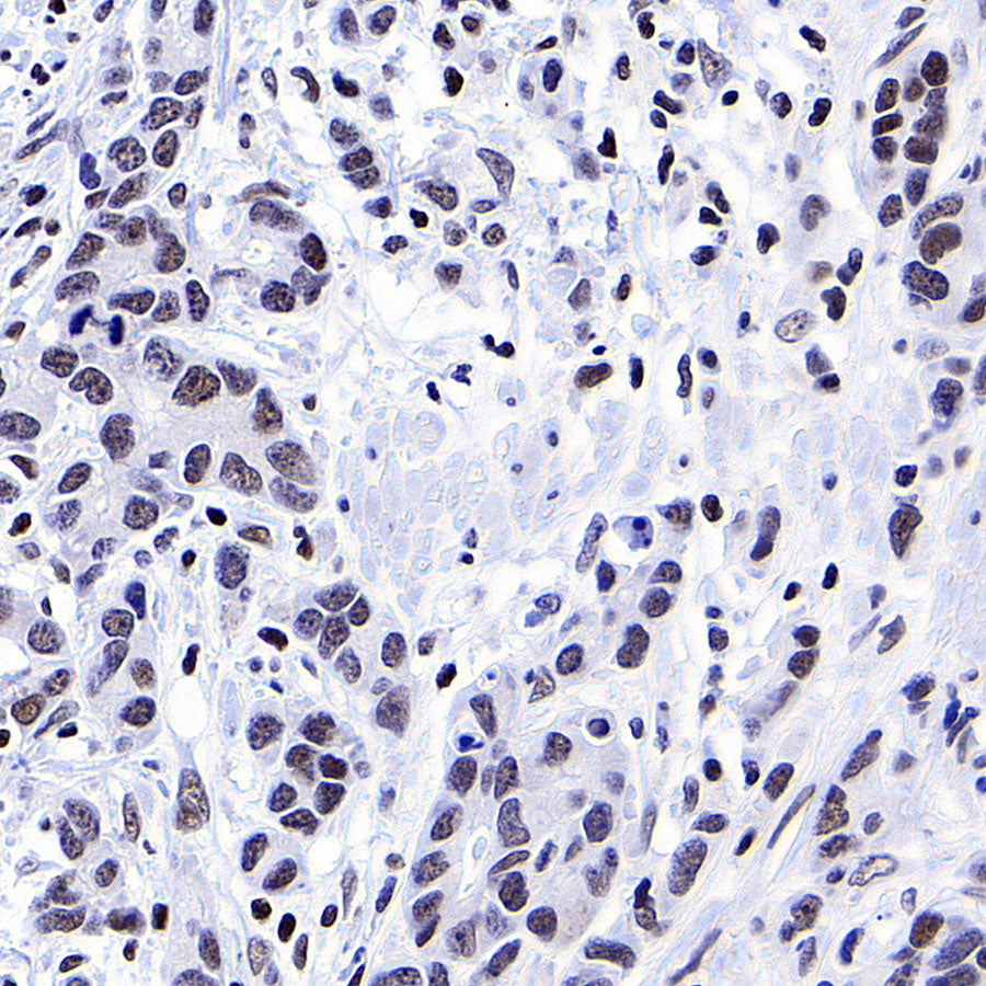 YY1 Recombinant Rabbit mAb (S-3652-44)