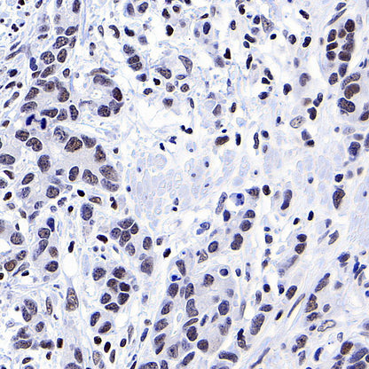 YY1 Recombinant Rabbit mAb (S-3652-44)