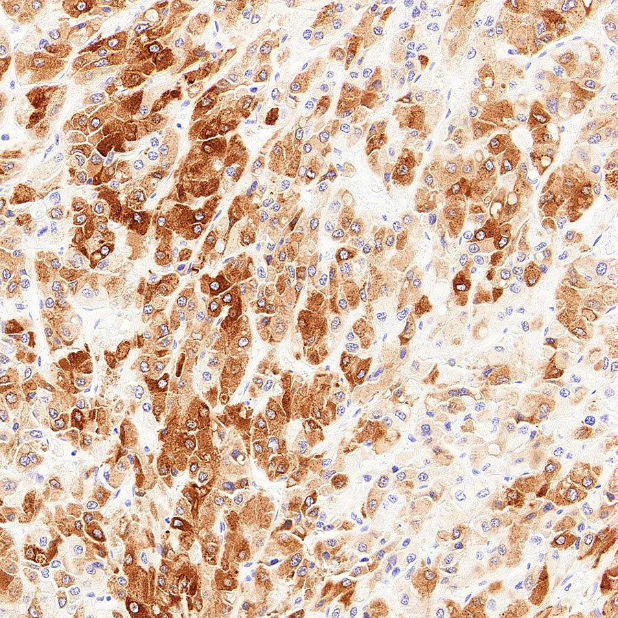 SCD Recombinant Rabbit mAb (S-4467-1)