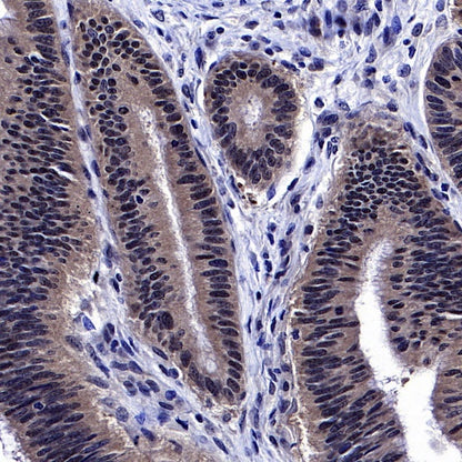 SMAD4 Recombinant Rabbit mAb (SDT-168-62)