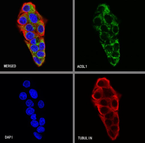 ACSL1 Recombinant Rabbit mAb (S-811-150)