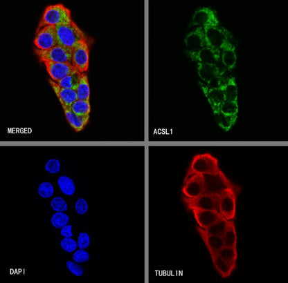 ACSL1 Recombinant Rabbit mAb (S-811-150)