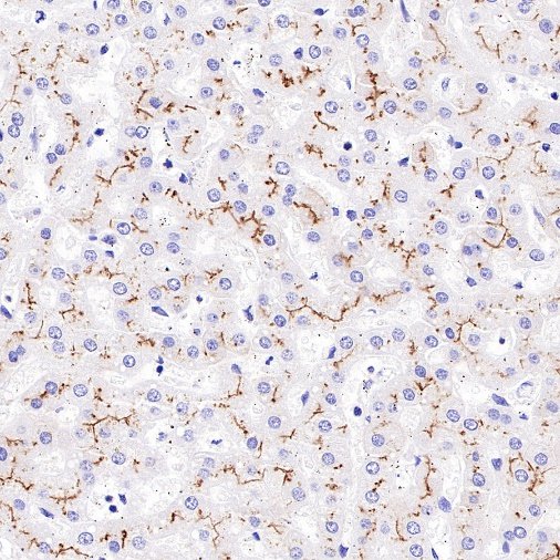 MDR1/ABCB1 Recombinant Rabbit mAb,PBS Only (SDT-872-21)