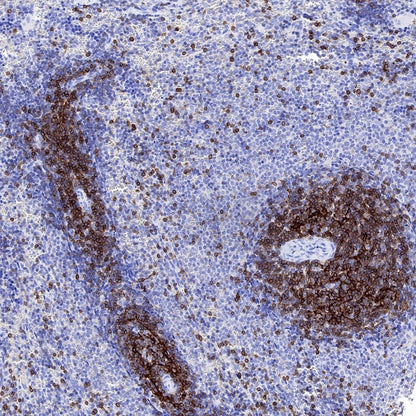 CCR7 Recombinant Rabbit mAb (S-999-29)