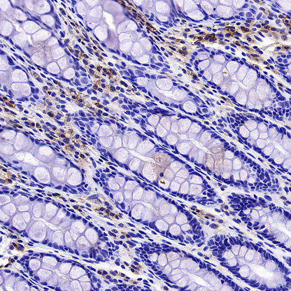 LILRB1 Recombinant Rabbit mAb (S-5001)