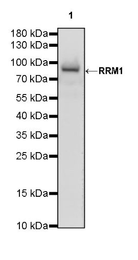 RRM1 Recombinant Rabbit mAb (S-587-21)