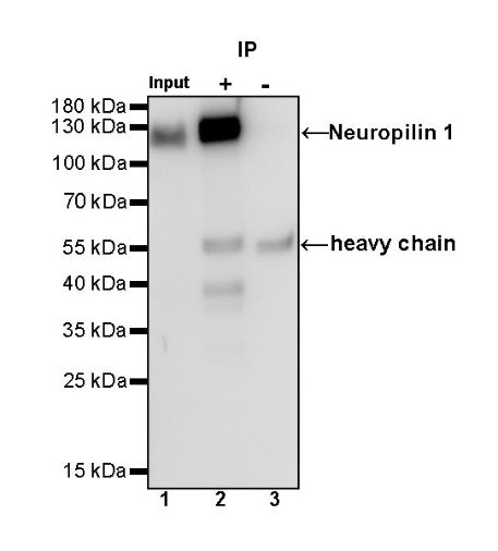 Neuropilin 1 Recombinant Rabbit mAb (S-1453-6)
