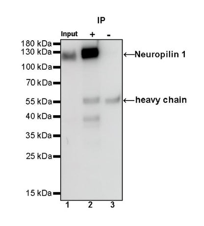 Neuropilin 1 Recombinant Rabbit mAb (S-1453-6)