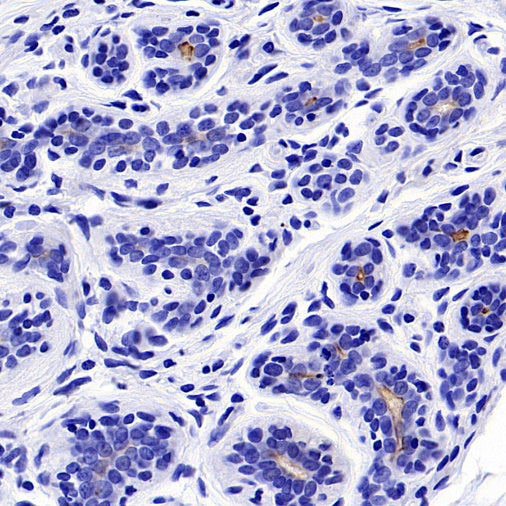 NaPi2b/SLC34A2 Recombinant Rabbit mAb (SDT-R229)