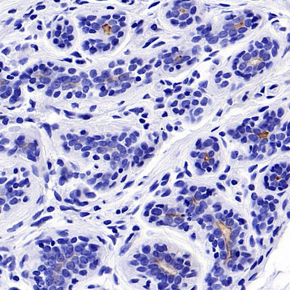 NaPi2b/SLC34A2 Recombinant Rabbit mAb (SDT-R229)