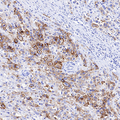 CDH17 Recombinant Rabbit mAb (SDT-3276-83)