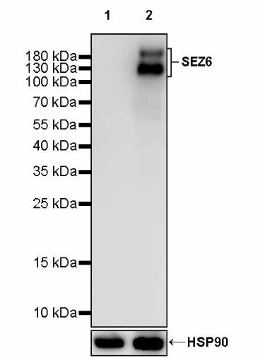 SEZ6 Recombinant Rabbit mAb (SDT-2097-737)