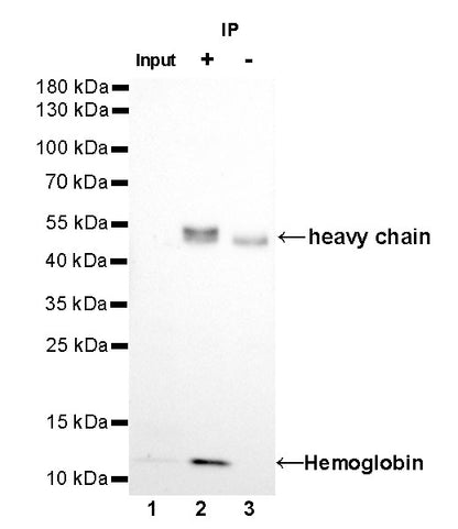 Hemoglobin Recombinant Rabbit mAb (SDT-193-71)