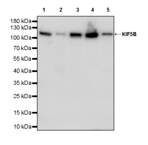 KIF5B+KIF5C Recombinant Rabbit mAb (S-2452-15)