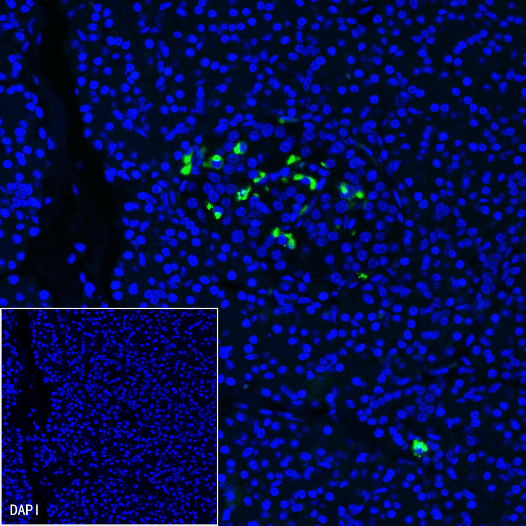 Somatostatin Recombinant Rabbit mAb (S-1103-79)