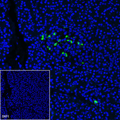 Somatostatin Recombinant Rabbit mAb (S-1103-79)