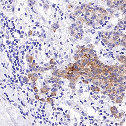 Phospho-IKKα/β (Ser176/180) Recombinant Rabbit mAb (S-4059)