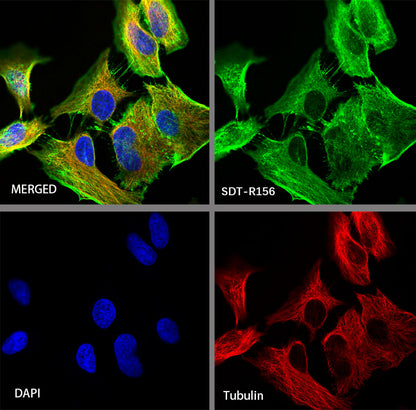 β-actin Recombinant Rabbit mAb (SDT-R156)