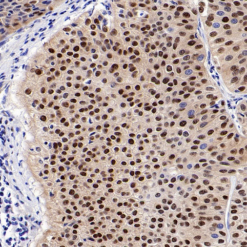 HSP70 Recombinant Rabbit mAb (S-992-39)