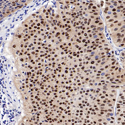 HSP70 Recombinant Rabbit mAb (S-992-39)