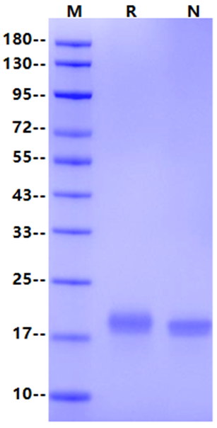 CD7 Ligand/SECTM1 His Tag Protein, Human