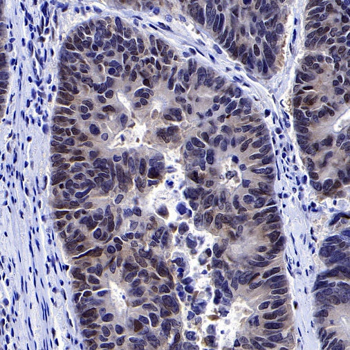 SMAD3 Recombinant Rabbit mAb (S-517-122)