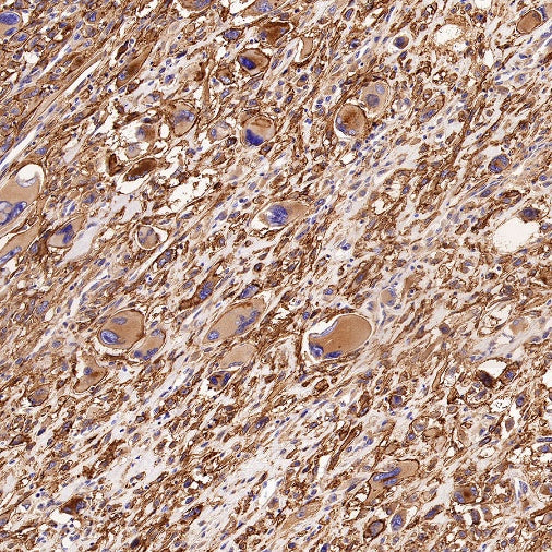 LRRC15 Recombinant Rabbit mAb (S-2473-43)
