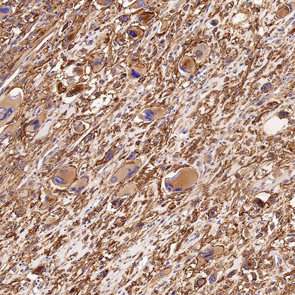 LRRC15 Recombinant Rabbit mAb (S-2473-43)