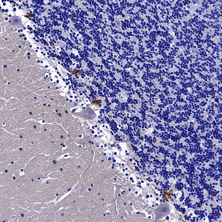 KCNA2 Recombinant Rabbit mAb (S-3939-53)