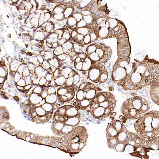 Ezrin Recombinant Rabbit mAb (S-1894-4)