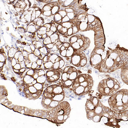 Ezrin Recombinant Rabbit mAb (S-1894-4)