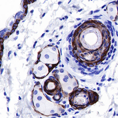keratin 6 Rabbit mAb (SDT-015-69)