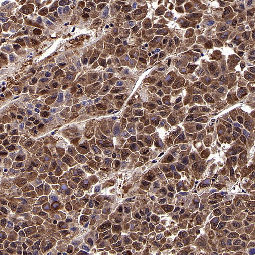 GSPT1 Recombinant Rabbit mAb (S-1914-49)
