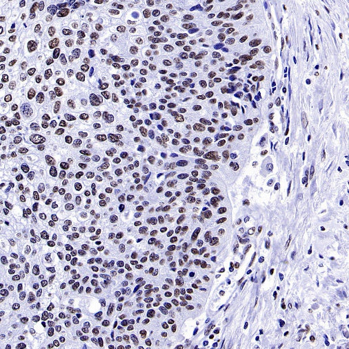 Histone H3 (tri methyl K4) Recombinant Rabbit mAb (S-1602-21)