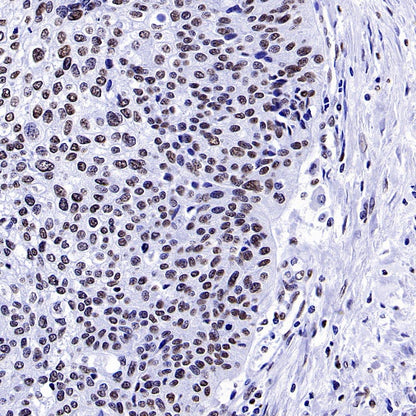 Histone H3 (tri methyl K4) Recombinant Rabbit mAb (S-1602-21)