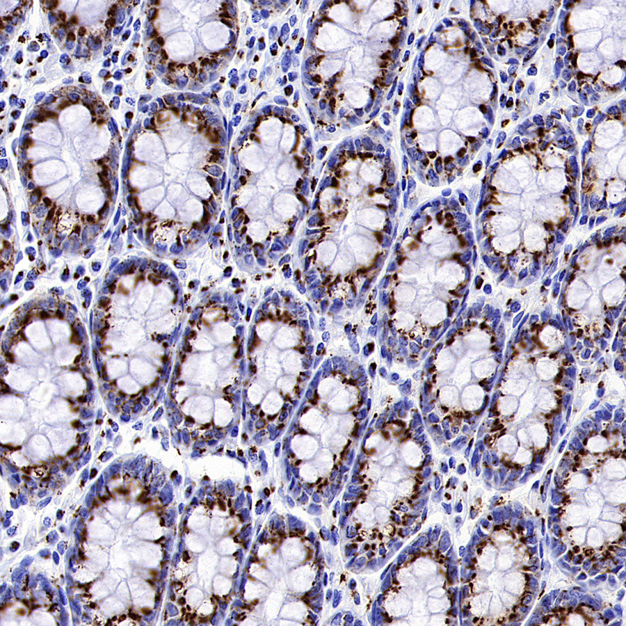 TGN46 Recombinant Rabbit mAb (S-3514-47)