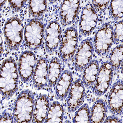 TGN46 Recombinant Rabbit mAb (S-3514-47)