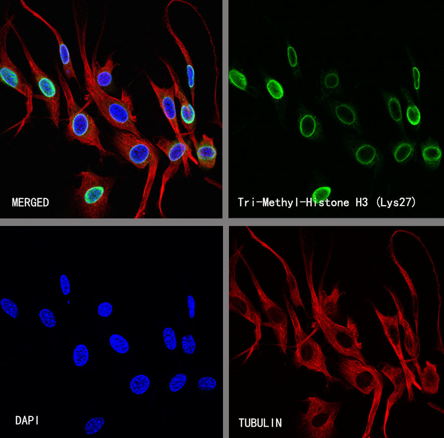 Histone H3 (tri methyl K27) Recombinant Rabbit mAb (S-4331)