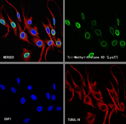 Histone H3 (tri methyl K27) Recombinant Rabbit mAb (S-4331)