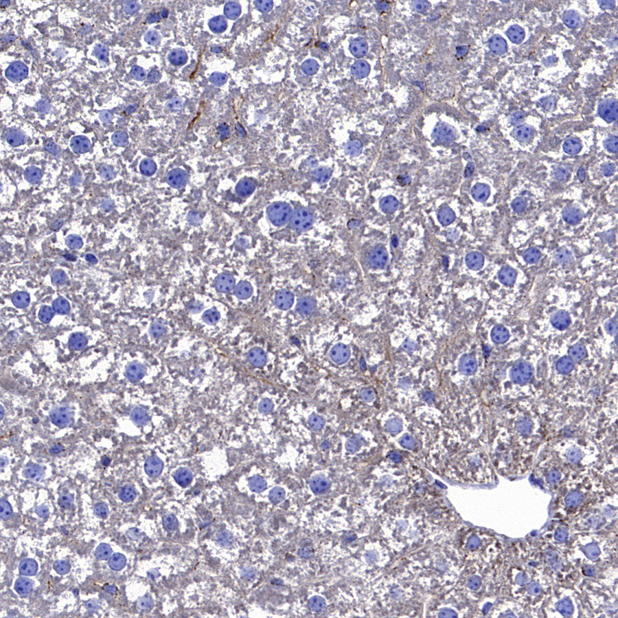 ALDH2 Recombinant Rabbit mAb (S-4173-20)