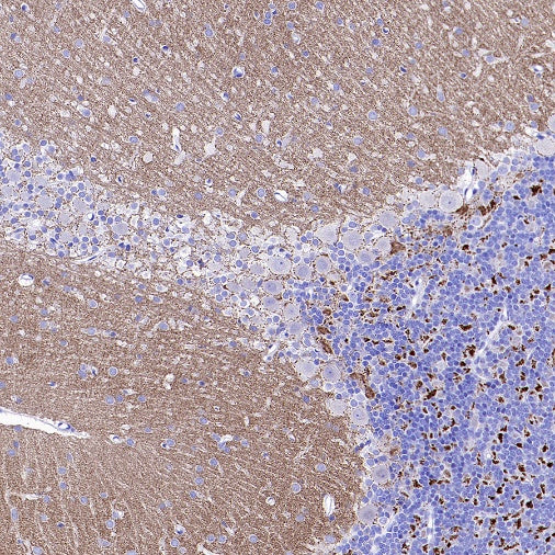 SYT2 Rabbit Polyclonal Antibody
