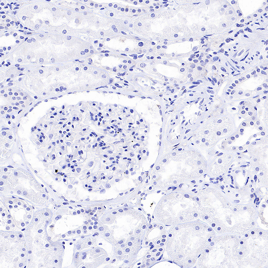 ARR3 Recombinant Rabbit mAb (S-3290-27)